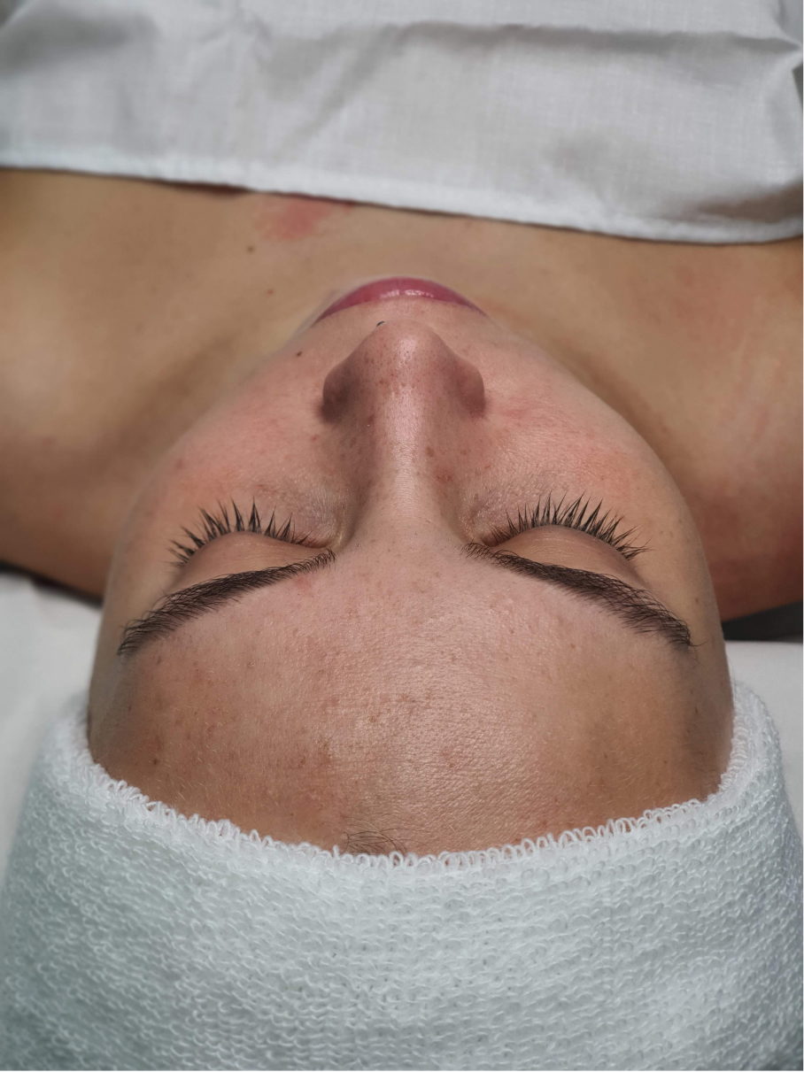 image00013 CURSO TÉCNICO ESPECIALISTA EN FACIAL